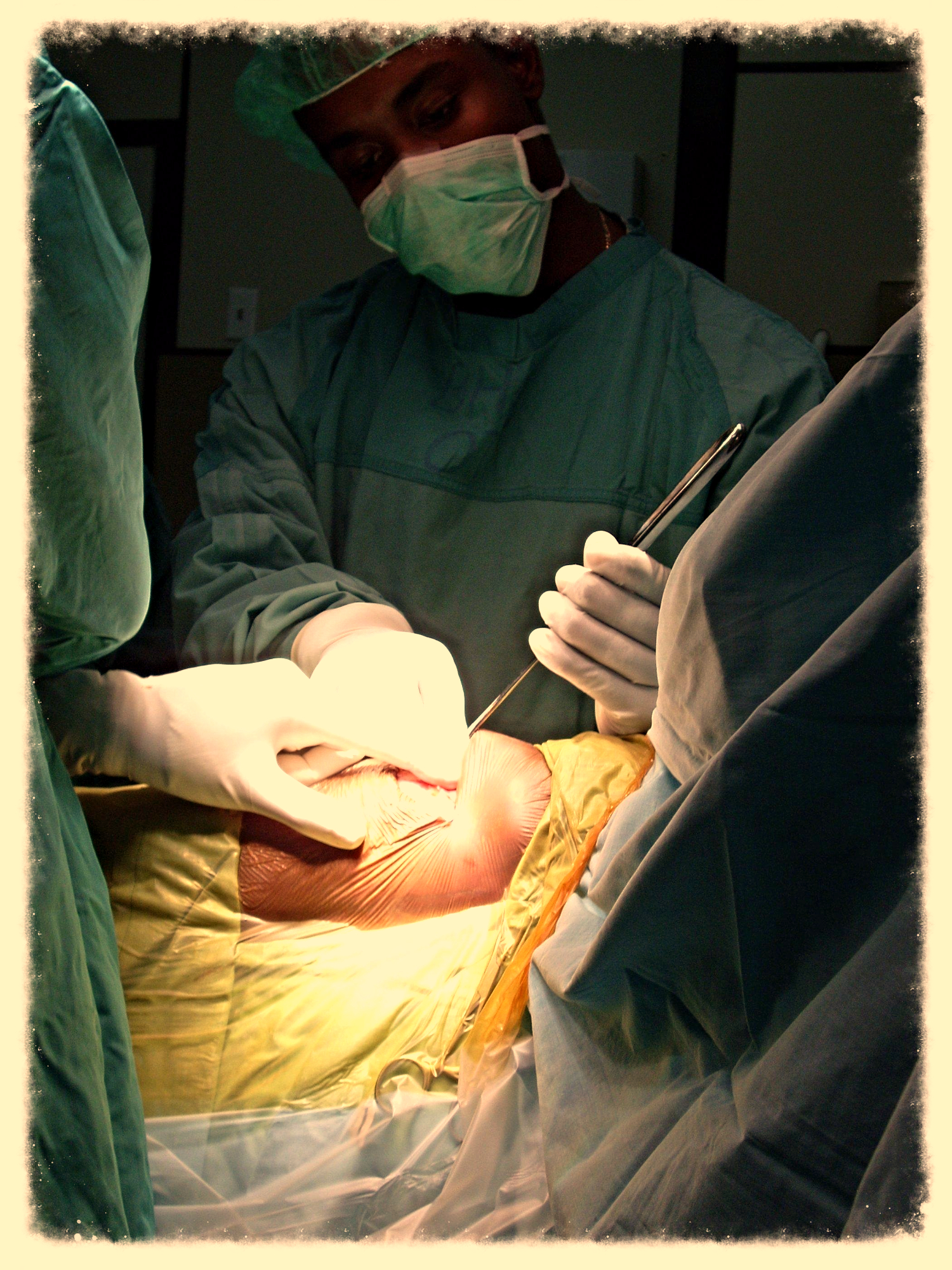 Epidural Tray